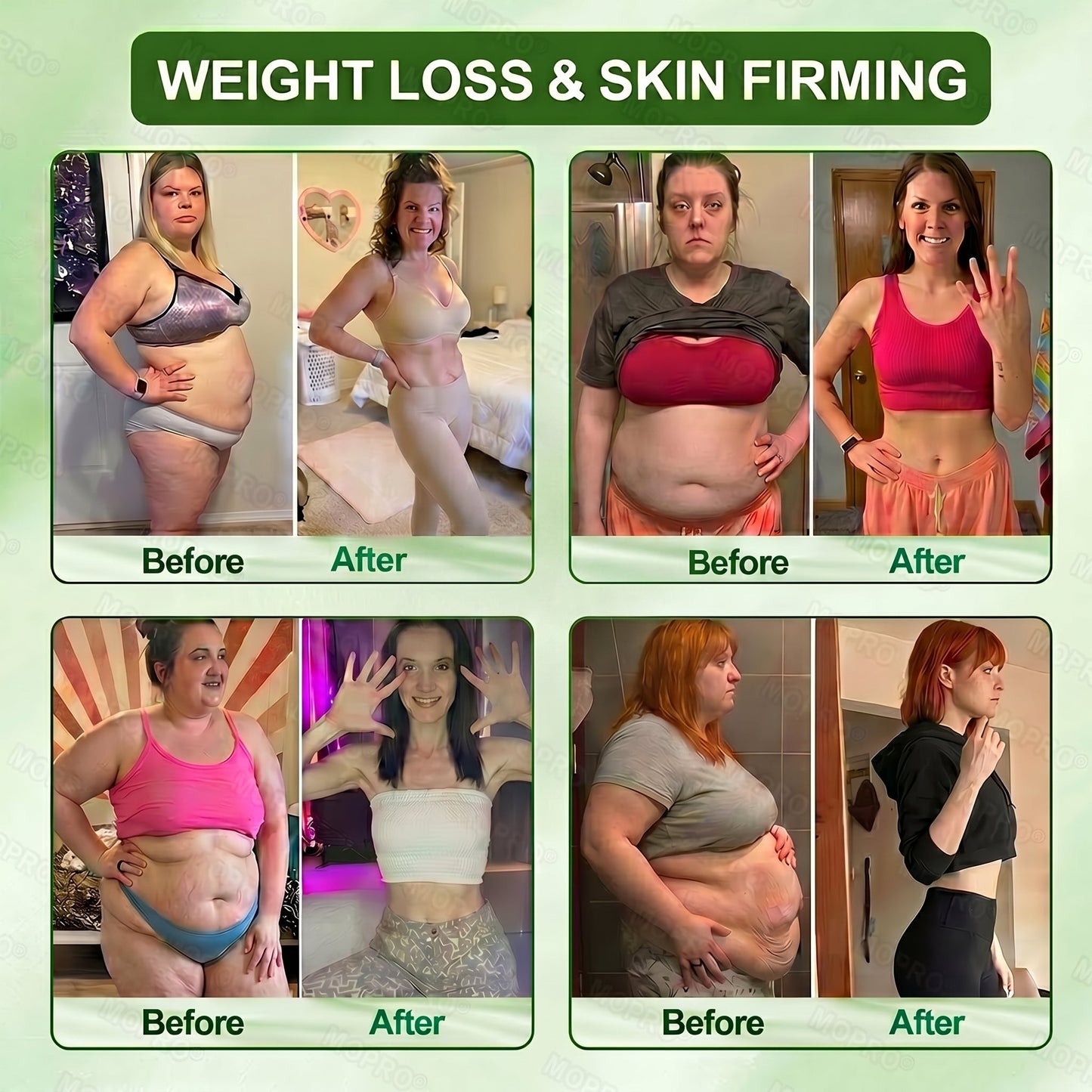 𝐌𝗢𝑷𝙍𝙊® ✅✅𝑨𝙆𝐊 · 𝐈𝗡𝙊𝐒𝙄𝑻𝐎𝐋 𝐁𝗼𝒅𝙮 𝐒𝗹𝒊𝙢𝙢𝐢𝒏𝙜 𝐀𝒎𝙥𝙤𝙪𝐥𝒆 𝐒𝒆𝙧𝙪𝙢 𝐂𝙧𝒂𝙫𝙞𝐧𝗴 𝐂𝙤𝒏𝙩𝗿𝙤𝐥 · 𝐌𝙚𝒕𝙖𝗯𝙤𝐥𝙞𝒔𝗺 𝐒𝙪𝒑𝙥𝗼𝙧𝐭 · 𝐋𝙞𝒈𝙝𝐭𝗲𝙧 𝐁𝙤𝒅𝙮 𝐅𝙚𝒆𝗹 · 𝐅𝙞𝒓𝗺𝙞𝐧𝗴 𝐒𝙪𝒑𝗽𝙤𝐫𝙩