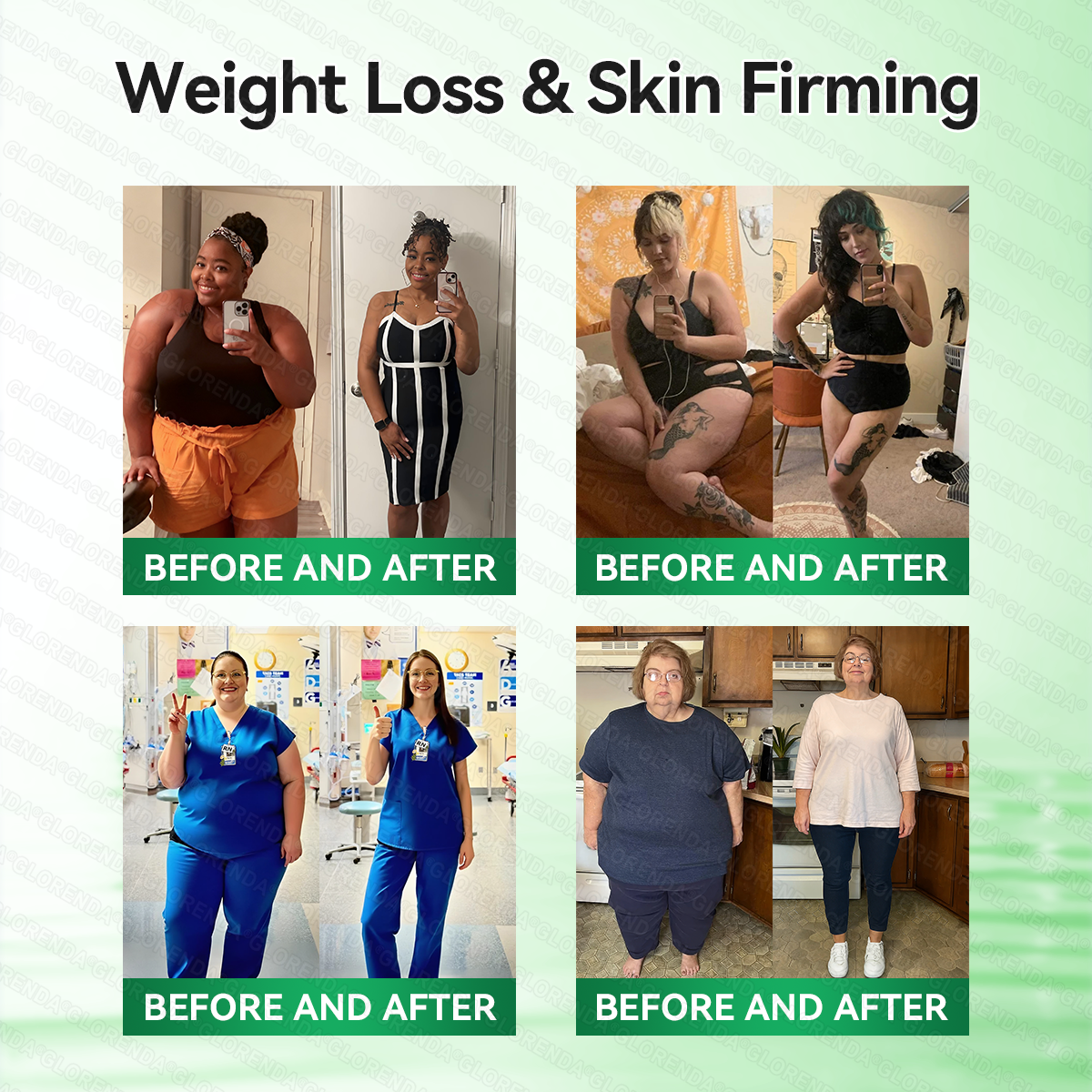 🇺🇸𝑶𝒇𝒇𝒊𝒄𝒊𝒂𝒍 𝒔𝒕𝒐𝒓𝒆  | 👩‍⚕️👩‍⚕️𝐆𝐋𝐎𝐑𝐄𝐍𝑫𝑨® 𝐌𝐨𝐫𝐢𝐧𝒈𝗮 𝑩𝒆𝒓𝒃𝒆𝐫𝐢𝐧𝐞𝐱 𝐍𝗔𝒟+ 10-𝑖n-1 𝐍a𝒏𝒐 𝐌𝐢𝐜𝐫𝑜𝑛𝑒𝑒𝗱𝗹𝗲 𝐏𝐚𝒕𝒄𝒉(𝐉𝐮𝐬𝐭 𝐨𝐧𝐜𝐞 𝐚 𝐝𝐚𝐲, 𝐯𝐢𝐬𝐢𝐛𝐥𝐞 𝐜𝐡𝐚𝐧𝐠𝐞𝐬 𝐢𝐧 𝟕 𝑫𝐚𝐲𝐬） ✅ 𝐅𝐨𝐫 𝐎𝐛𝐞𝐬𝐢𝐭𝐲,  𝙇𝙊𝙊𝙎𝗘 𝗦𝗞𝗜𝗡,𝐝𝐢𝐚𝐛𝐞𝐭𝙚𝙨, 𝐬𝐥𝐞𝐞𝐏 𝐚𝐩𝐧𝐞𝐚, 𝐣𝐨𝐢𝐧𝐭 𝐢𝐬𝐬𝐮𝙚𝙨, 𝐚𝐧𝐝 𝐦𝐨𝐫𝐞